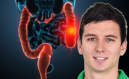 James Devin has studied the effects of exercise on colorectal cancer survivors. James Devin has studied the effects of exercise on colorectal cancer survivors.
